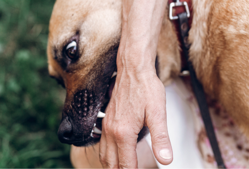 Bit by a Dog at a Public Place